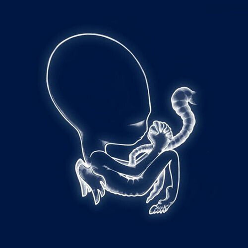 Sigur Ros: Agaetis Byrjun { Vinyl }